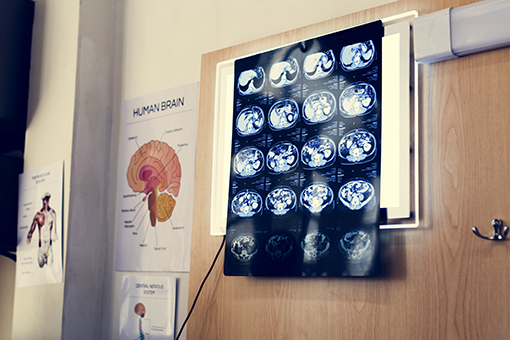 neuropsicologia